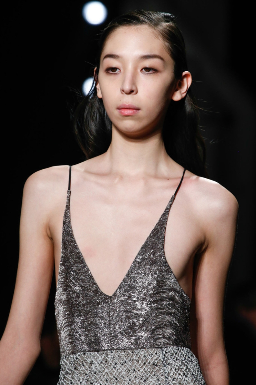 Models with defects in appearance: ugliness or a highlight? Models with defects in appearance: ugliness or a highlight?