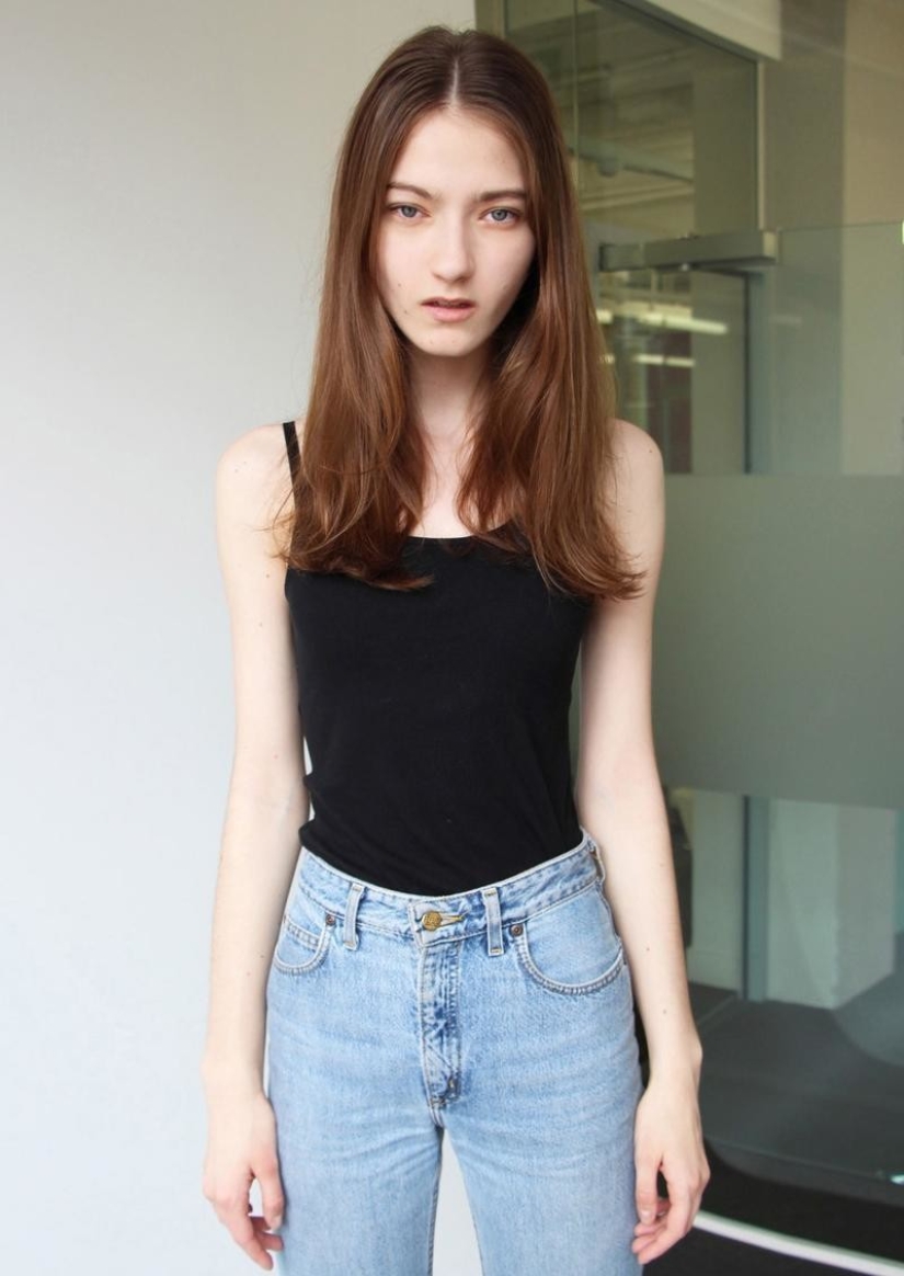 Models with defects in appearance: ugliness or a highlight? Models with defects in appearance: ugliness or a highlight?