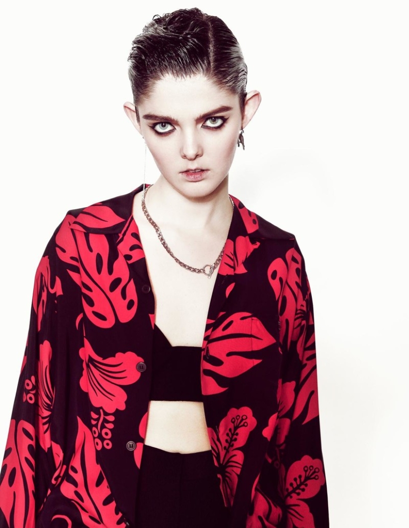 Models with defects in appearance: ugliness or a highlight? Models with defects in appearance: ugliness or a highlight?