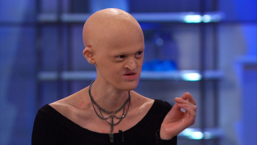 Models with defects in appearance: ugliness or a highlight? Models with defects in appearance: ugliness or a highlight?