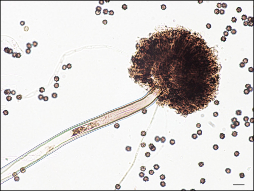 Parasites that live in and near your bed Parasites that live in and near your bed