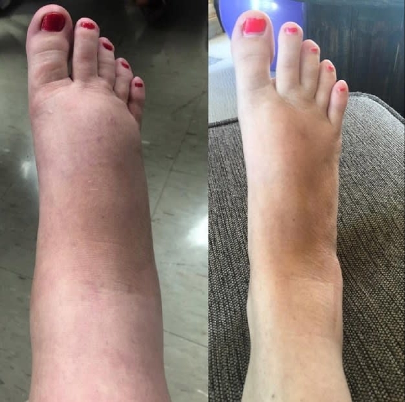 Piernas enormes, vientre enorme, todo enorme: 22 fotos sobre la realidad de las mujeres embarazadas