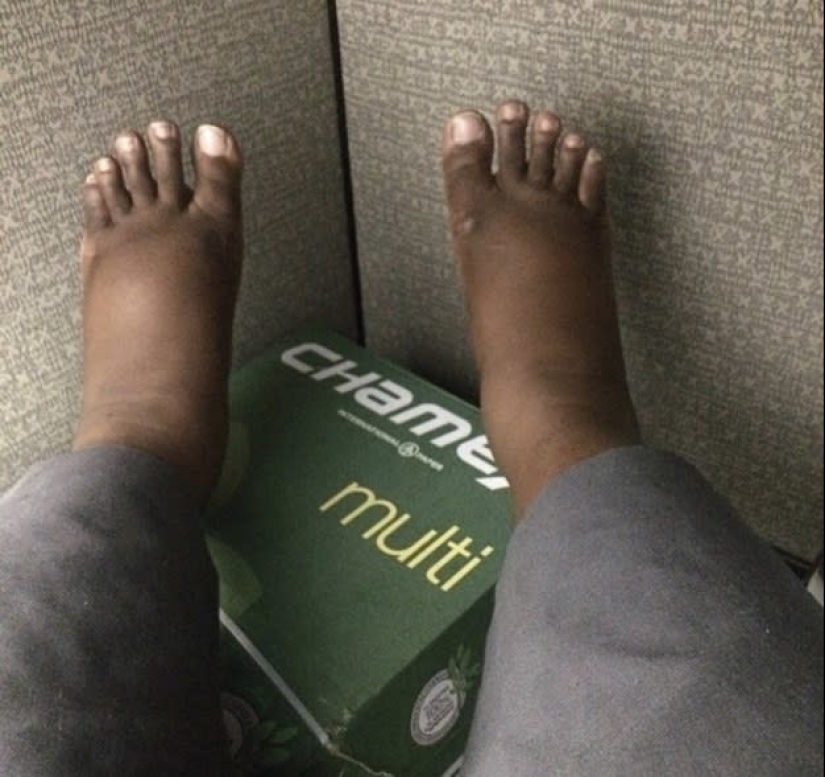 Piernas enormes, vientre enorme, todo enorme: 22 fotos sobre la realidad de las mujeres embarazadas