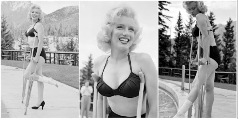 Plaster-beauty is not a hindrance: rare photos of Marilyn Monroe on crutches