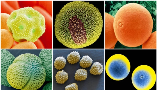 Polen bajo el microscopio