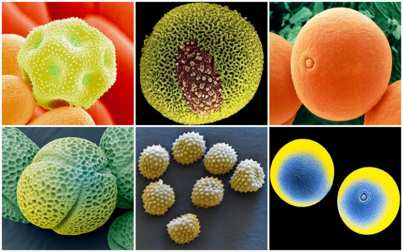 Pollen under a microscope