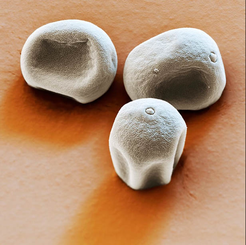 Pollen under a microscope