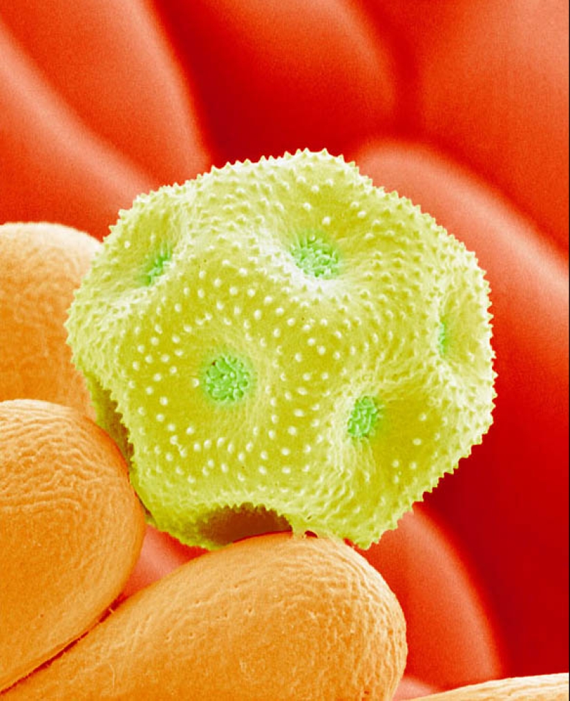 Pollen under a microscope