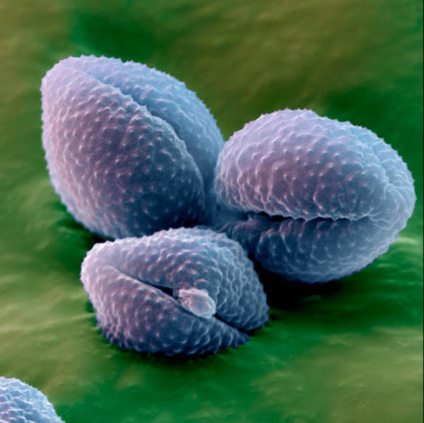 Pollen under a microscope