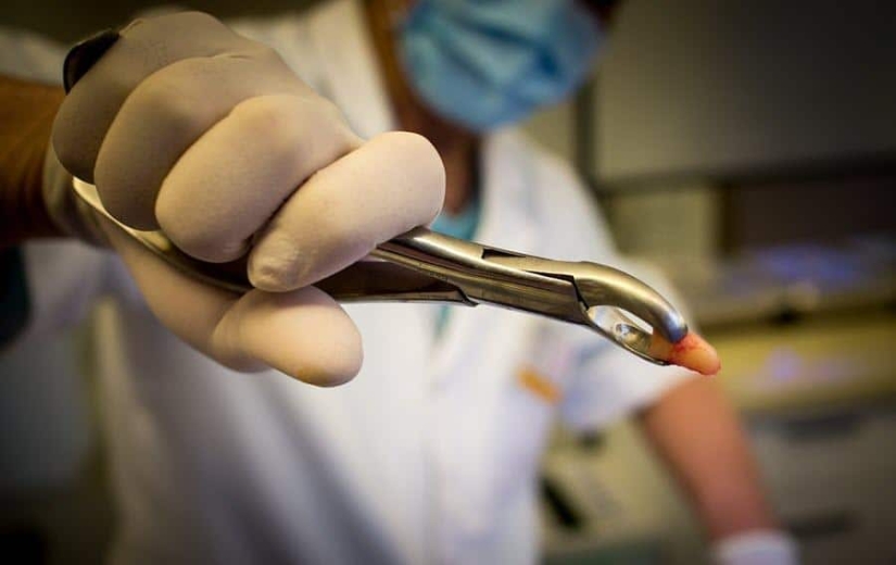 ¿Por qué sueñas con perder dientes y vale la pena tener miedo de tal sueño ¿Por qué sueñas con perder dientes y vale la pena tener miedo de tal sueño