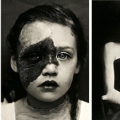 Portraits of pain: striking photographs of patients from nineteenth-century suffering from serious illnesses Portraits of pain: striking photographs of patients from nineteenth-century suffering from serious illnesses