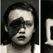 Portraits of pain: striking photographs of patients from nineteenth-century suffering from serious illnesses Portraits of pain: striking photographs of patients from nineteenth-century suffering from serious illnesses