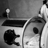 Prisoners of the "Iron lung": how to rescue victims of polio, have forgotten how to breathe