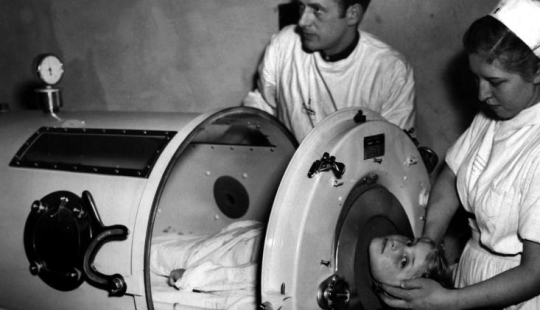 Prisoners of the "Iron lung": how to rescue victims of polio, have forgotten how to breathe