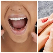 Reducimos el estrés por nuestra cuenta: en qué partes del cuerpo se acumula el estrés