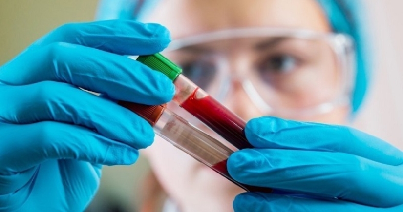 "Sangre dorada" con un factor Rh cero: por qué es saludable y peligroso a la vez