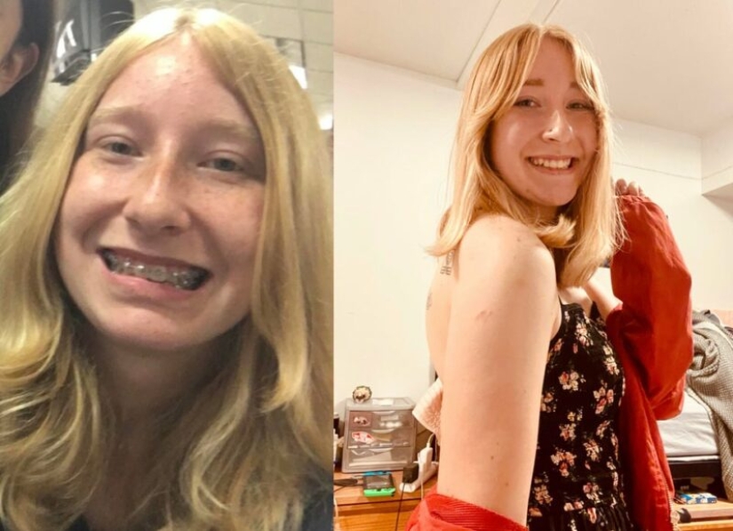 School Ugly Ducklings: 22 Amazing Transformations Over the Years School Ugly Ducklings: 22 Amazing Transformations Over the Years