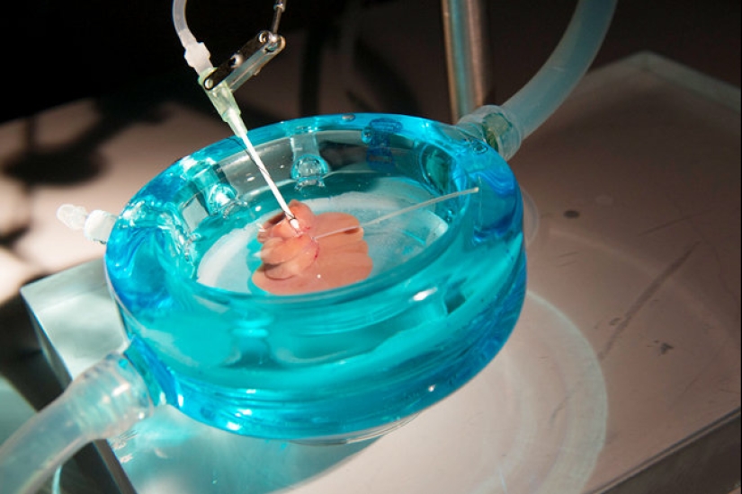 Scientists have found an eternally young organ in humans Scientists have found an eternally young organ in humans