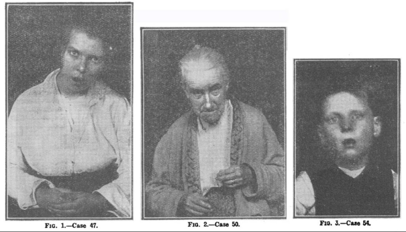 “Sleeping sickness”: the story of an epidemic whose causes were never found “Sleeping sickness”: the story of an epidemic whose causes were never found
