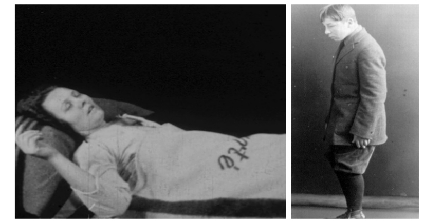 “Sleeping sickness”: the story of an epidemic whose causes were never found “Sleeping sickness”: the story of an epidemic whose causes were never found