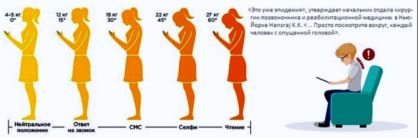 Síndrome de cuello de texto: qué es peligroso y cómo deshacerse de él