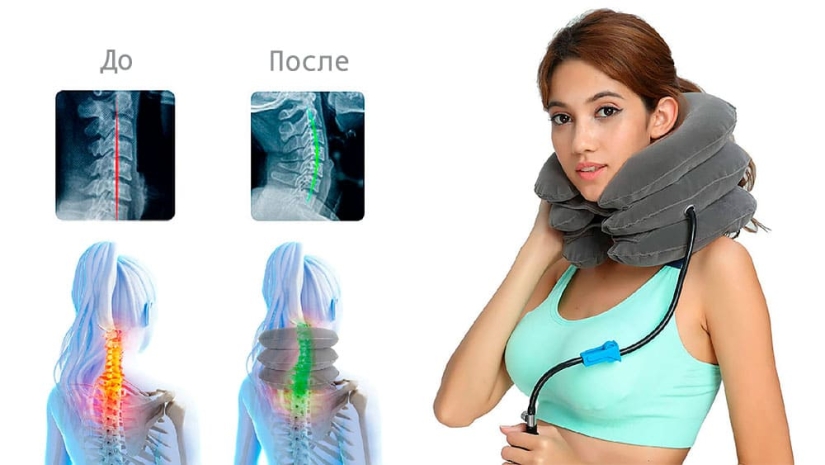 Síndrome de cuello de texto: qué es peligroso y cómo deshacerse de él