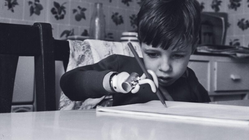 Talidomida tragedia, o Como una "píldora milagrosa" para destruir a los cuerpos y vidas de las personas Talidomida tragedia, o Como una "píldora milagrosa" para destruir a los cuerpos y vidas de las personas