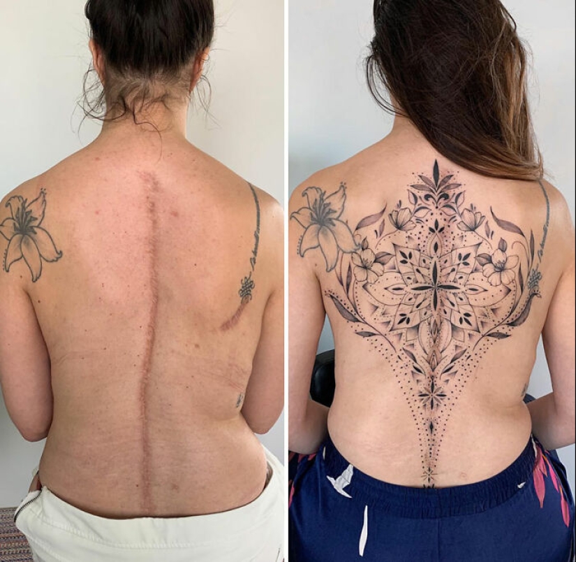 Tattoo Artist Covers Scars With Delicate Designs, And Here Are Her 10 Best Transformations