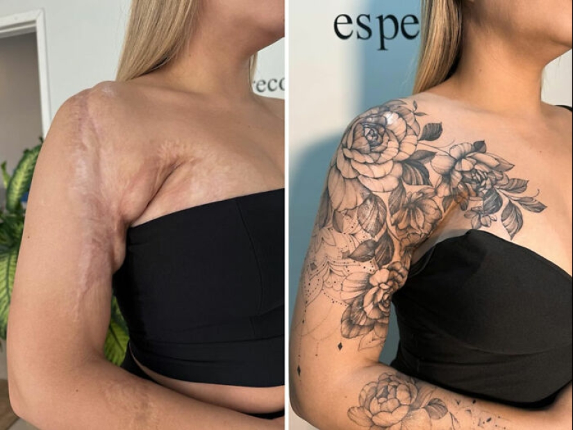 Tattoo Artist Covers Scars With Delicate Designs, And Here Are Her 10 Best Transformations