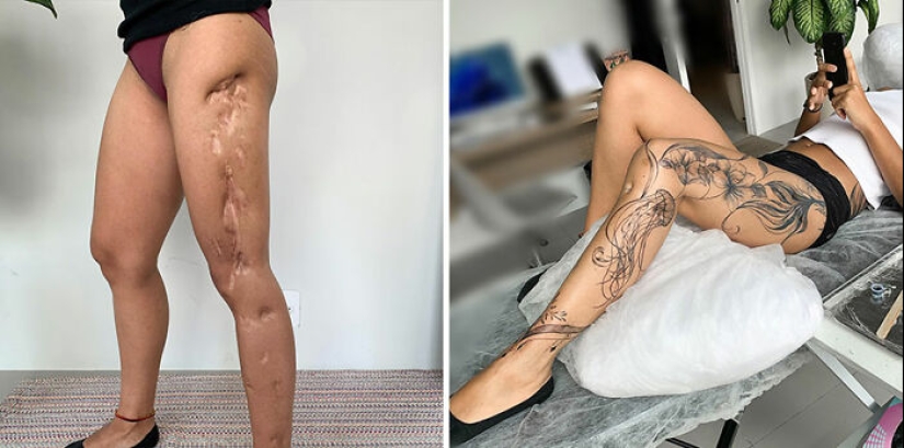 Tattoo Artist Covers Scars With Delicate Designs, And Here Are Her 10 Best Transformations