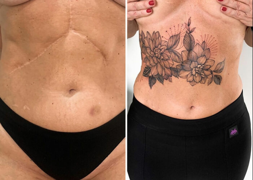 Tattoo Artist Covers Scars With Delicate Designs, And Here Are Her 10 Best Transformations