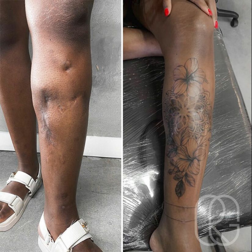 Tattoo Artist Covers Scars With Delicate Designs, And Here Are Her 10 Best Transformations