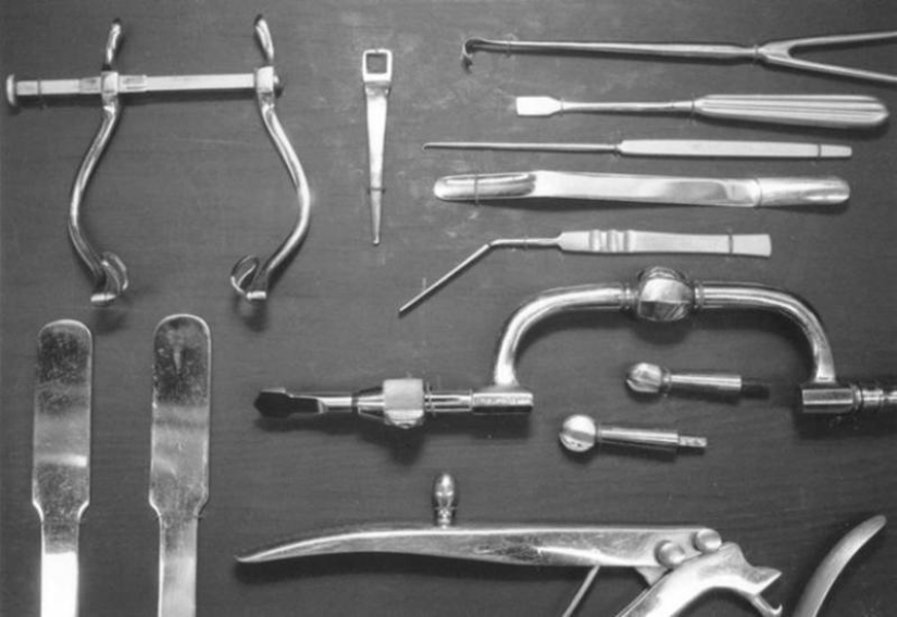Terrible "medicine" of quarrelsomeness and nymphomania: Top 10 frightening facts about lobotomies