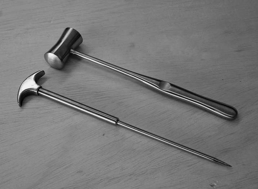 Terrible "medicine" of quarrelsomeness and nymphomania: Top 10 frightening facts about lobotomies
