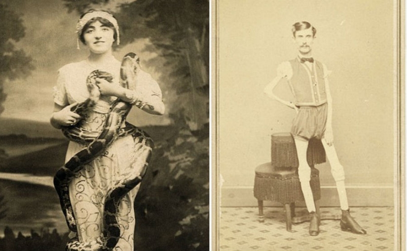 The harsh 19th century: a collection of archival photographs of people with deformities The harsh 19th century: a collection of archival photographs of people with deformities