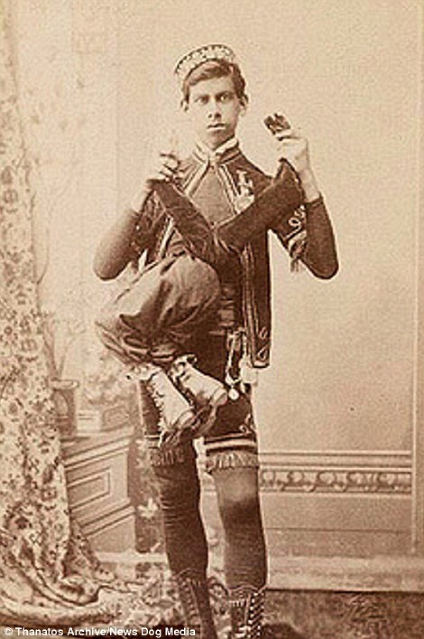 The harsh 19th century: a collection of archival photographs of people with deformities The harsh 19th century: a collection of archival photographs of people with deformities