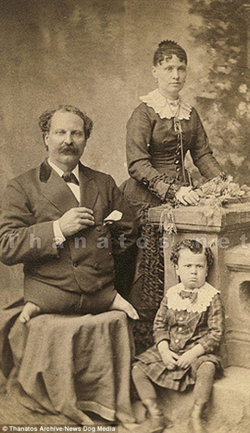 The harsh 19th century: a collection of archival photographs of people with deformities The harsh 19th century: a collection of archival photographs of people with deformities