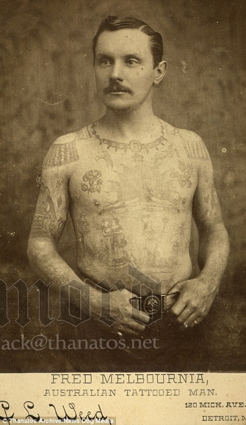 The harsh 19th century: a collection of archival photographs of people with deformities The harsh 19th century: a collection of archival photographs of people with deformities