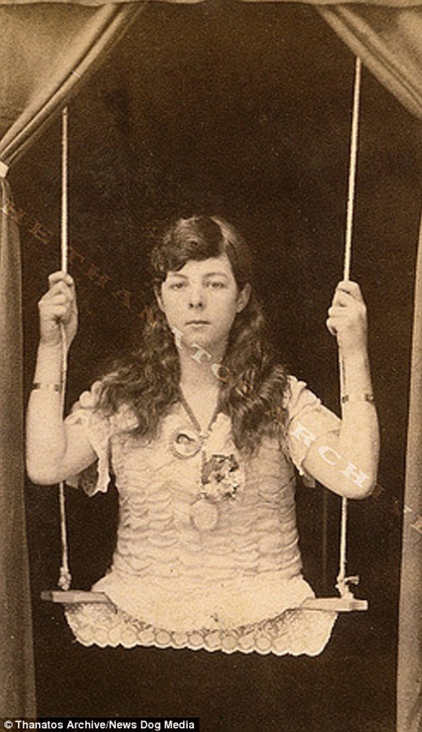 The harsh 19th century: a collection of archival photographs of people with deformities The harsh 19th century: a collection of archival photographs of people with deformities