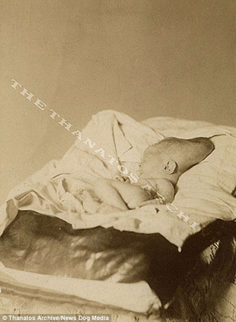 The harsh 19th century: a collection of archival photographs of people with deformities The harsh 19th century: a collection of archival photographs of people with deformities