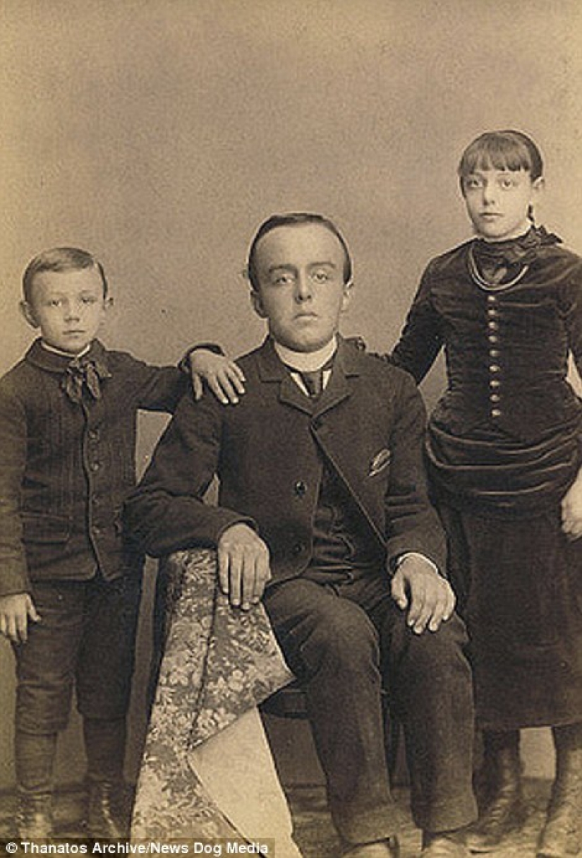 The harsh 19th century: a collection of archival photographs of people with deformities The harsh 19th century: a collection of archival photographs of people with deformities