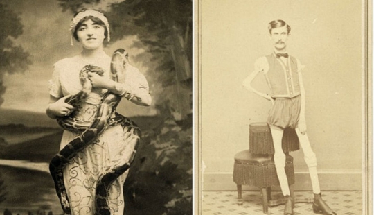 The harsh 19th century: a collection of archival photographs of people with deformities