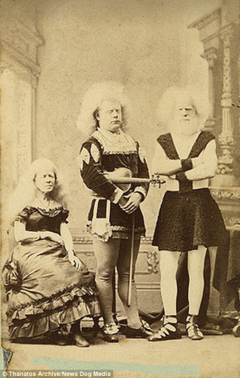 The harsh 19th century: a collection of archival photographs of people with deformities The harsh 19th century: a collection of archival photographs of people with deformities