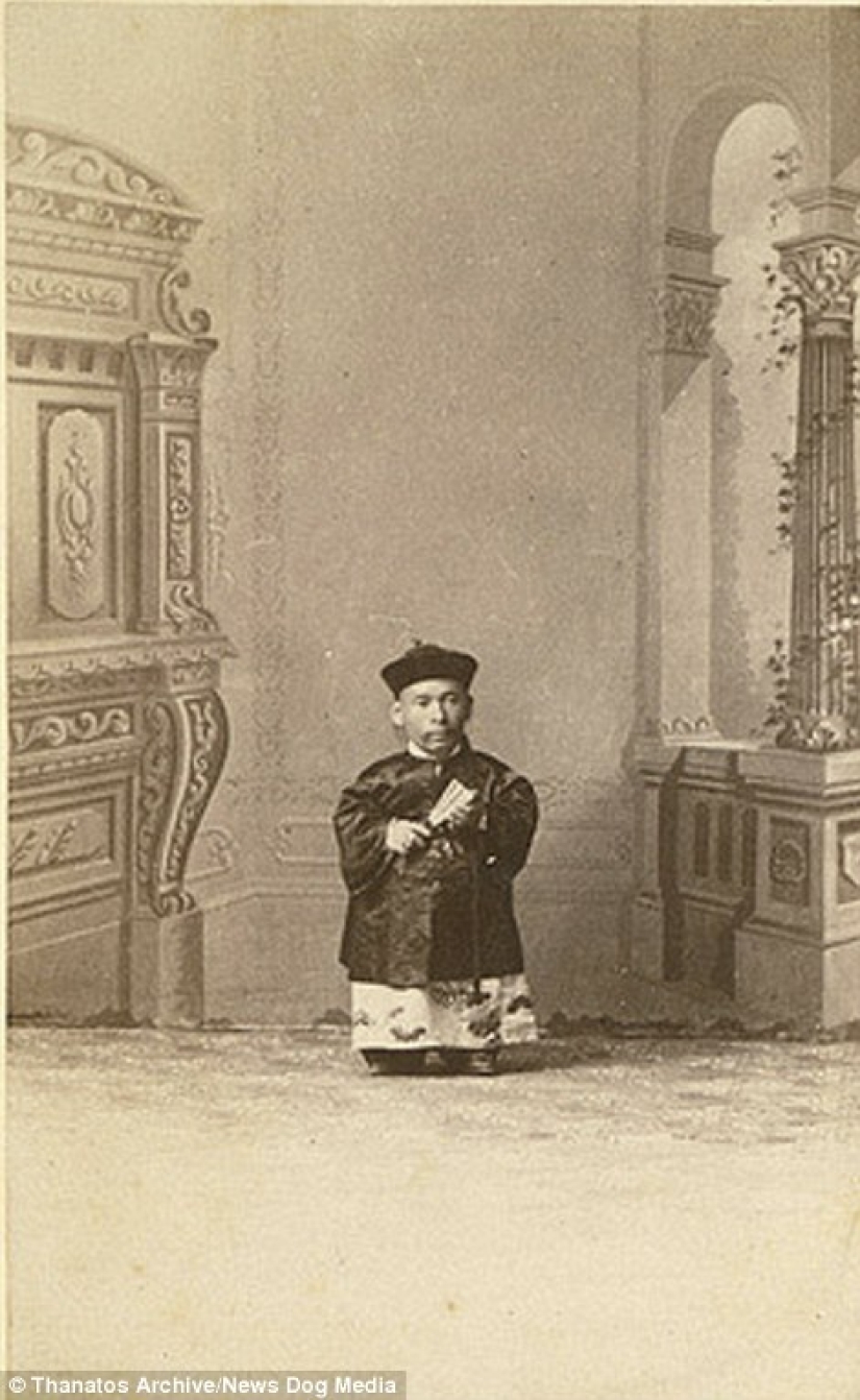 The harsh 19th century: a collection of archival photographs of people with deformities The harsh 19th century: a collection of archival photographs of people with deformities