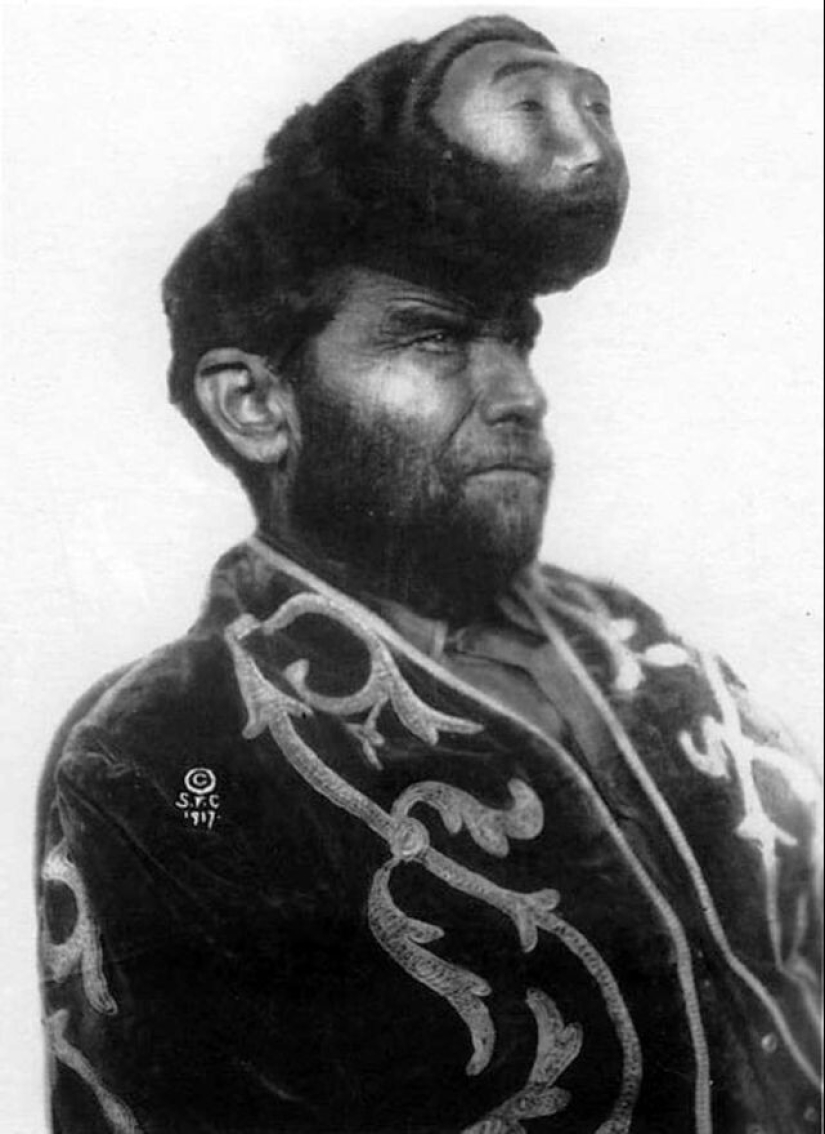 The man with two heads: portraits of Pasqual Pinon, the beginning of the twentieth century The man with two heads: portraits of Pasqual Pinon, the beginning of the twentieth century