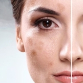 The result is obvious: as computers and smartphones spoil your skin The result is obvious: as computers and smartphones spoil your skin
