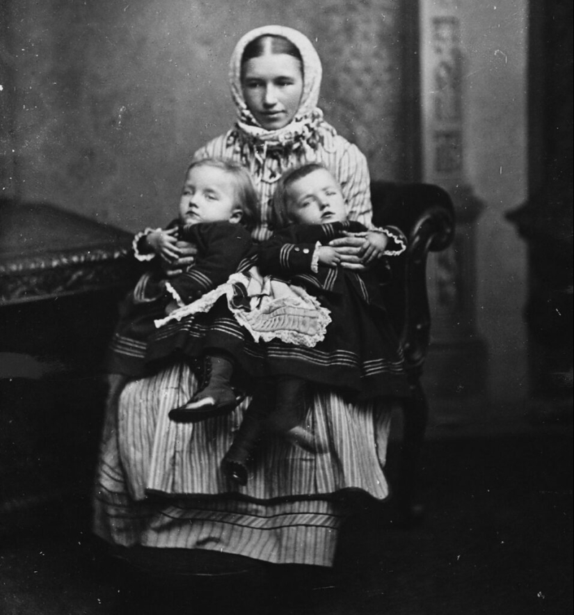 The story of conjoined twins, the Blazek sisters, one of whom gave birth to a child The story of conjoined twins, the Blazek sisters, one of whom gave birth to a child