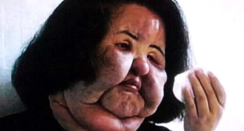 The story of Hang Mioku - a woman who, in pursuit of beauty, turned herself into a monster