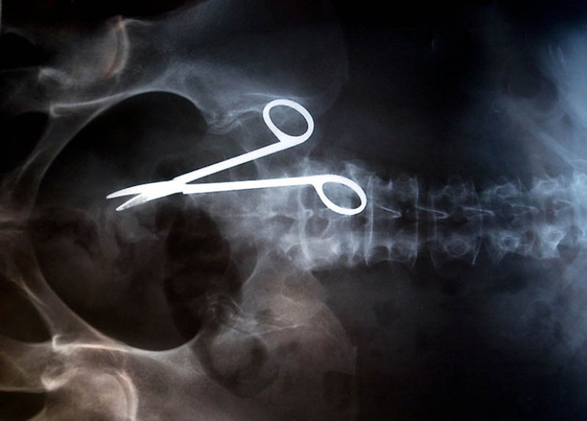 The strangest X-rays