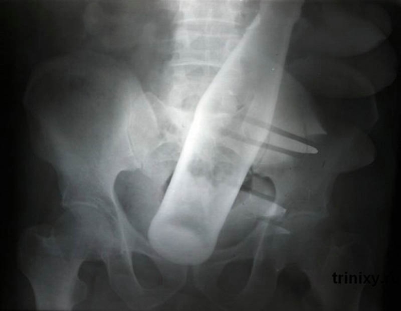 The strangest X-rays